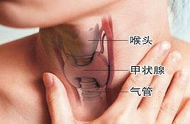 甲亢